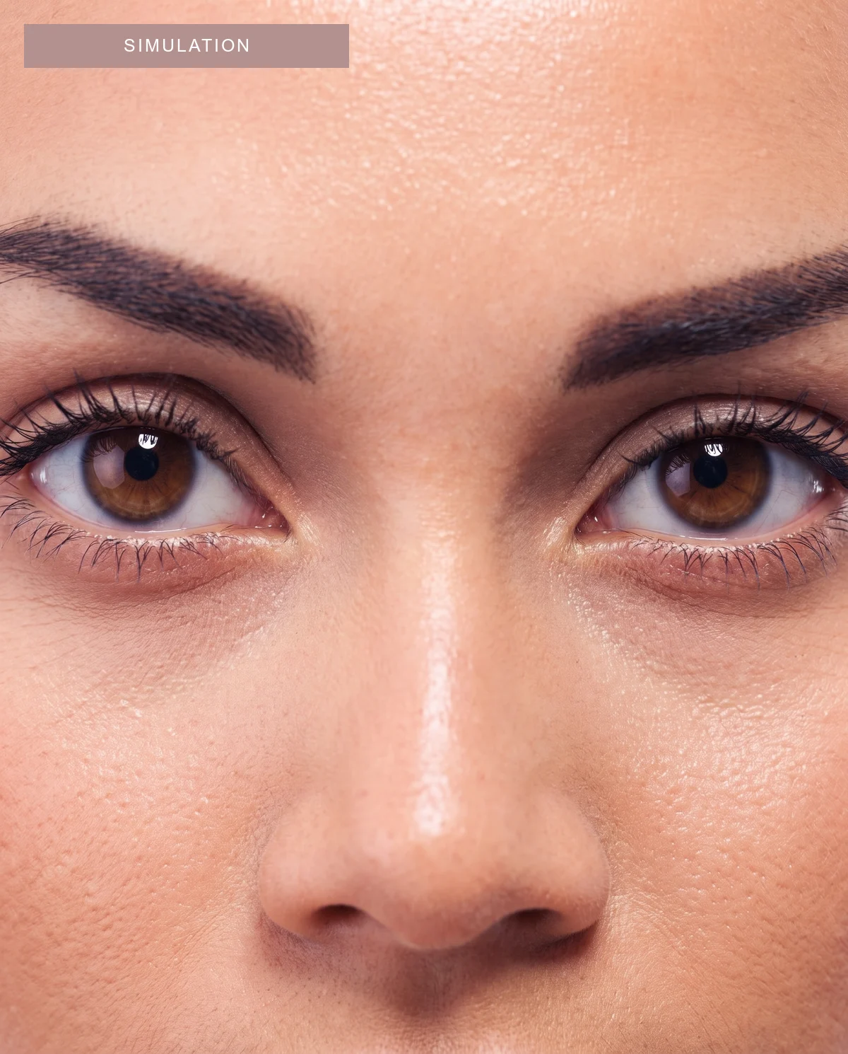 FORMA MX-Eye — Digital simulation · Eye contour